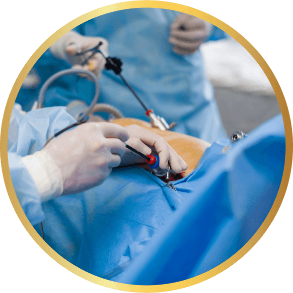 Imagem destaque Laparoscopia OncoGin